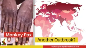 Read more about the article Monkey Pox- Another Breakout