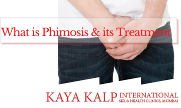 You are currently viewing What is Phimosis and How to Treat it