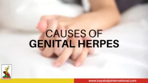 Herpes Treatment in Mumbai