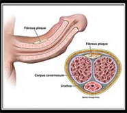 affordable sexual treatment in india