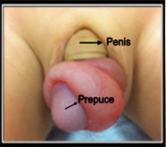 first male sexual problems treatment in mumbai