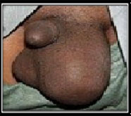 foremost male sexual problems treatment in mumbai