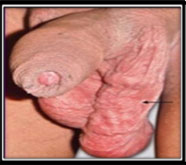 leading male sexual problems treatment in mumbai