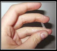 leading sexual treatment in india
