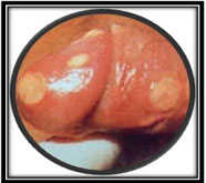 optimal male sexual problems treatment in mumbai