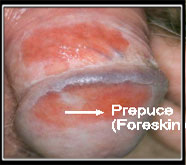 optimum male sexual problems treatment in mumbai