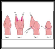 incomparable sexual treatment in india