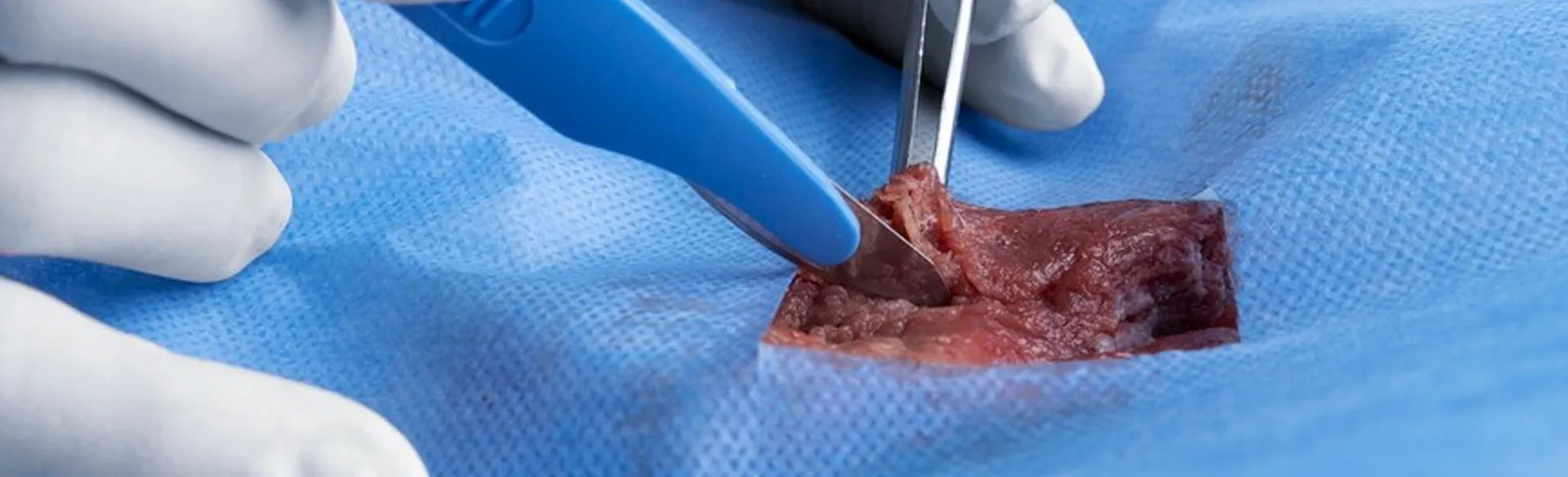 renowned circumcision treatment near me
