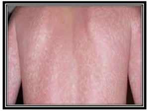 top hiv treatment in mumbai top hiv treatment near me