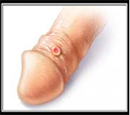ultimate male sexual problems treatment in mumbai