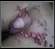 number-one sexual treatment in india