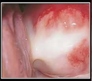 unexcelled male sexual problems treatment in mumbai