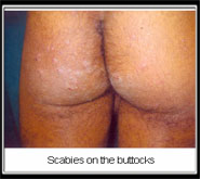 par excellence sexual treatment in india